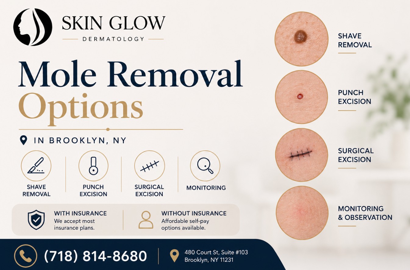 Mole removal options in Brooklyn, NY including shave removal, punch excision, surgical excision, and mole monitoring at Skin Glow Dermatology.